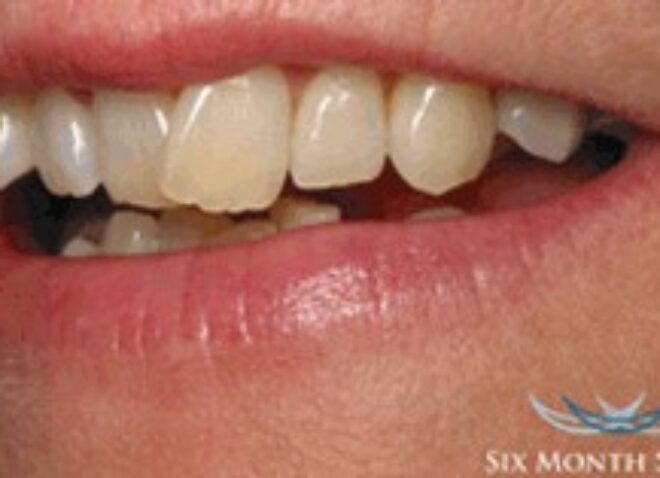 Before - Dentistree dental