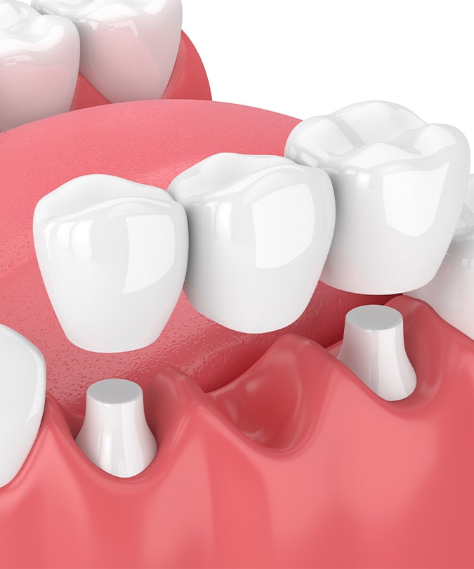 Treatment - Dentistree dental