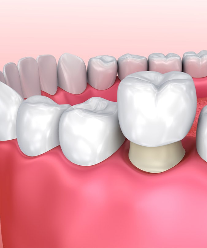 Treatment - Dentistree dental