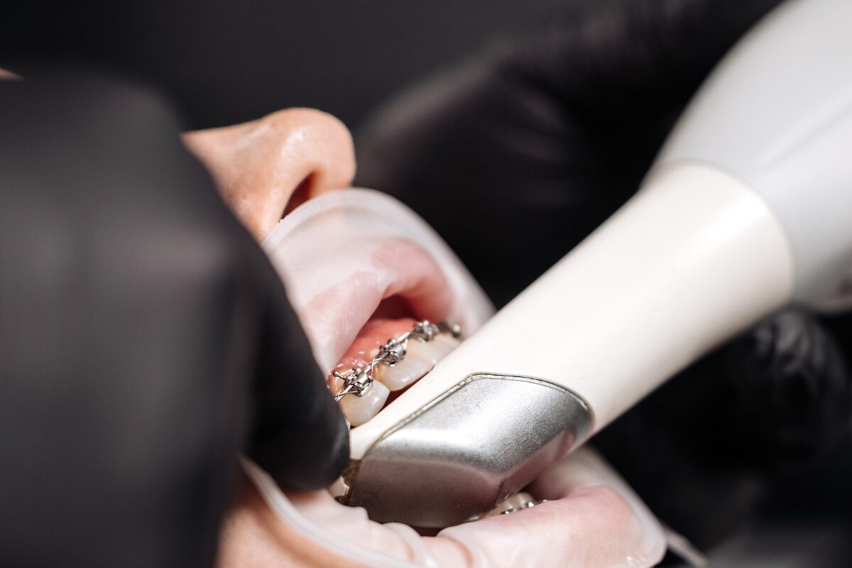 State of the art technology