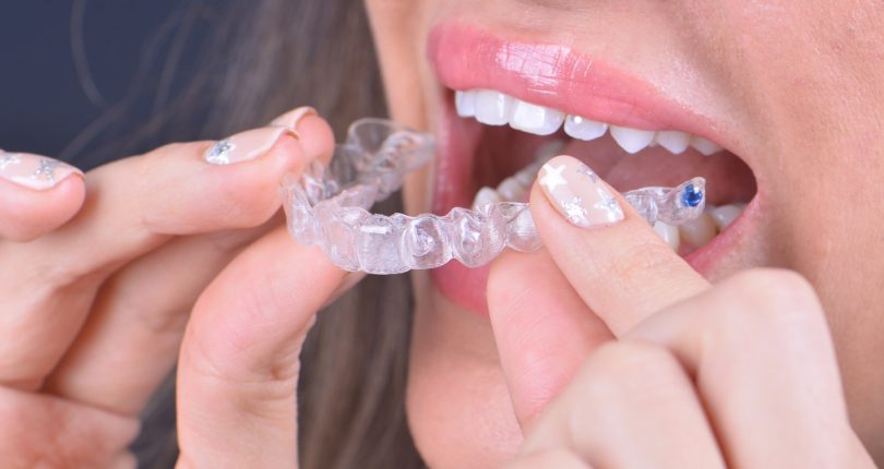 Invisalign